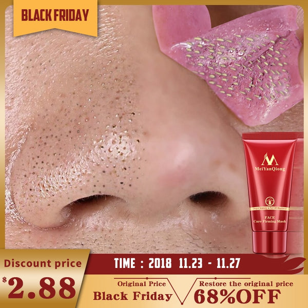 Black mud Facial face mask Remove - Thejewellerystyle